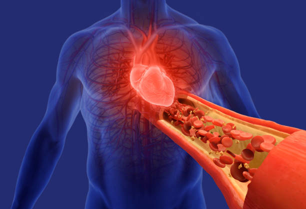 Total Arterial Bypass Surgeon