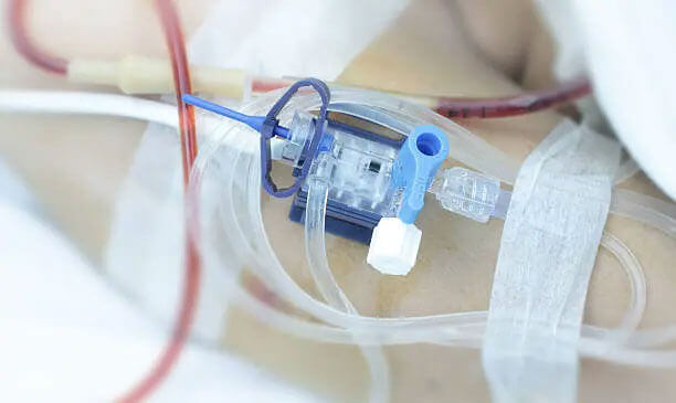 IABP Insertion